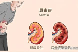 太阳报：若降级减薪，埃弗顿球员考虑采取法律行动索赔